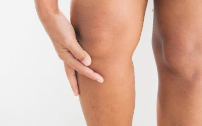 Jambes lourdes, œdèmes, circulation de retour compliquée ? Mes pistes naturelles