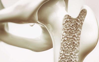 L’hypo-estrogénie, la ménopause et l’ostéoporose