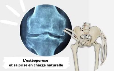 Ostéoporose prise en charge – L&rsquo;approche naturelle